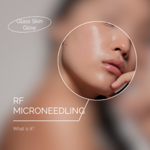 RF Microneedling